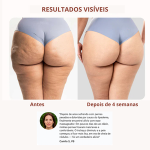 Drena Roller – Massajador Linfático para Lipedema e Celulite