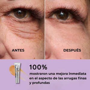 DermaLise Alisador Instantâneo para o Contorno de Olhos