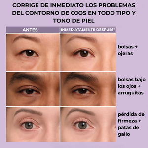DermaLise Alisador Instantâneo para o Contorno de Olhos