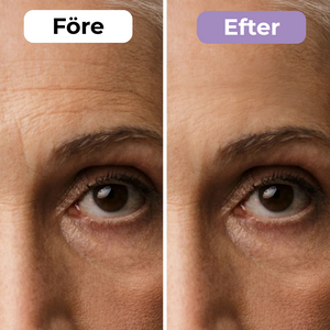 SilkoLapp™ - Proteção suave para uma pele mais suave