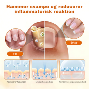 FungiStop – Spray de Cuidado de Unhas Antifúngico Avançado