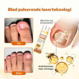 FungiStop – Spray de Cuidado de Unhas Antifúngico Avançado