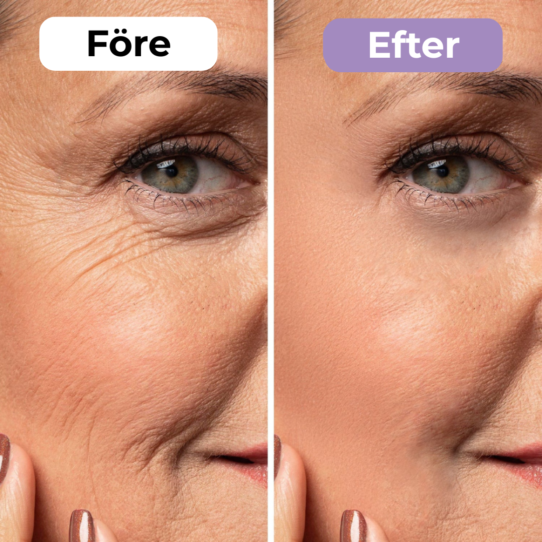 SilkoLapp™ - Proteção suave para uma pele mais suave