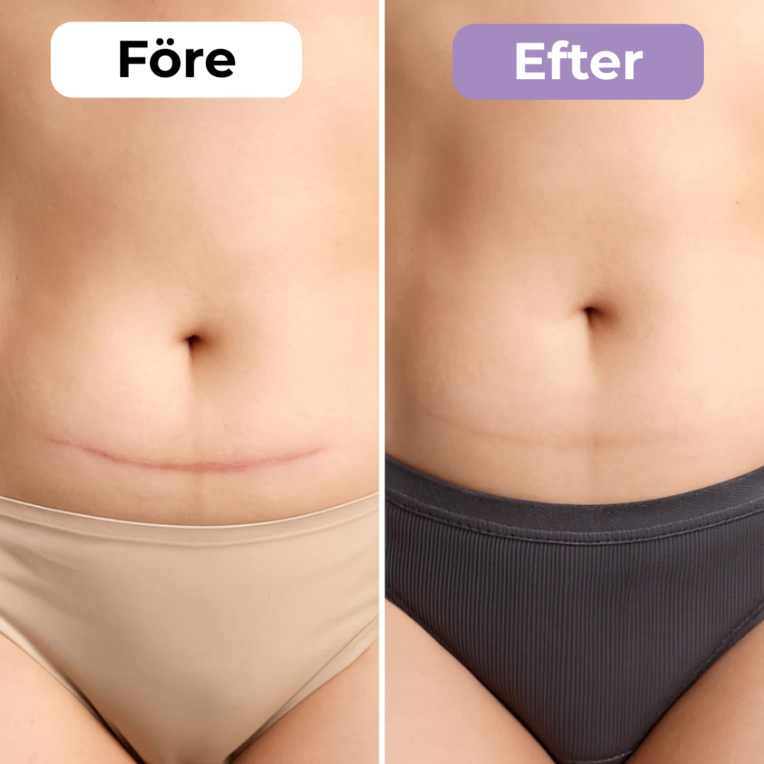 SilkoLapp™ - Proteção suave para uma pele mais suave