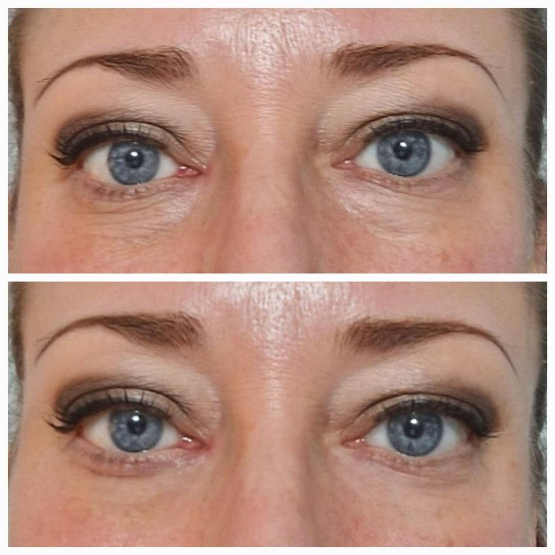 DermaLise Alisador Instantâneo para o Contorno de Olhos