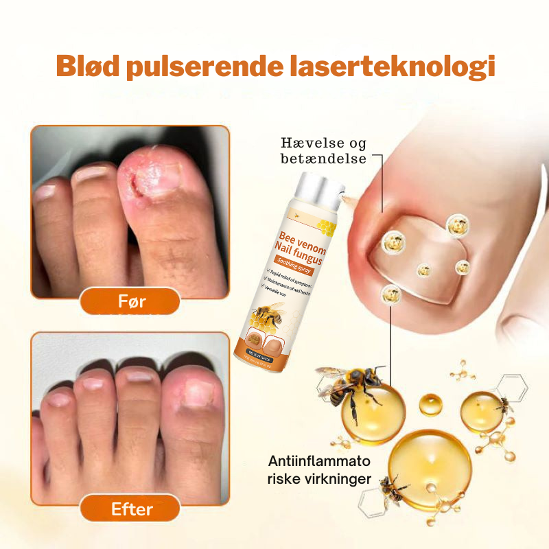 FungiStop – Spray de Cuidado de Unhas Antifúngico Avançado