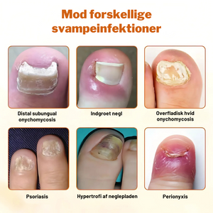 FungiStop – Spray de Cuidado de Unhas Antifúngico Avançado